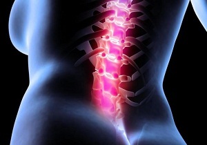 the causes of back pain